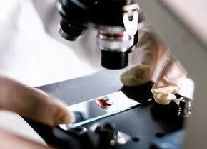 A close-up shot of the middle of a microscope with a fluid sample being viewed